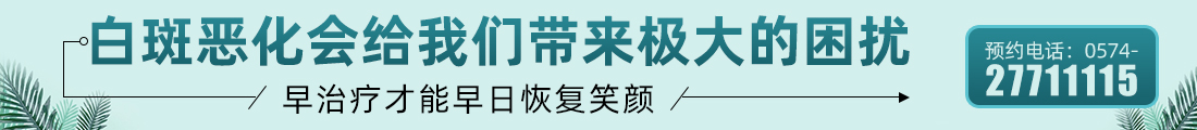 宁波有那些白癜风专家